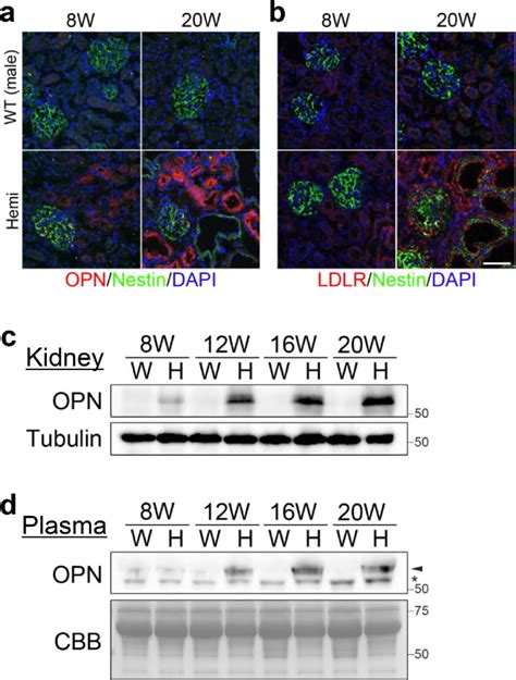 Opn And Ldlr Expressions In Col Deficient Rats A B Immunostaining