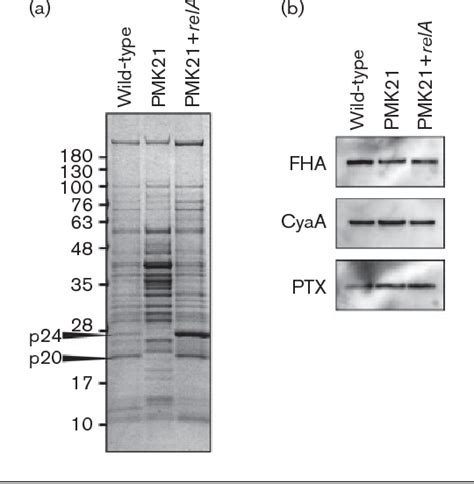 Role Of P Ppgpp In Biofilm Formation And Expression Of Filamentous