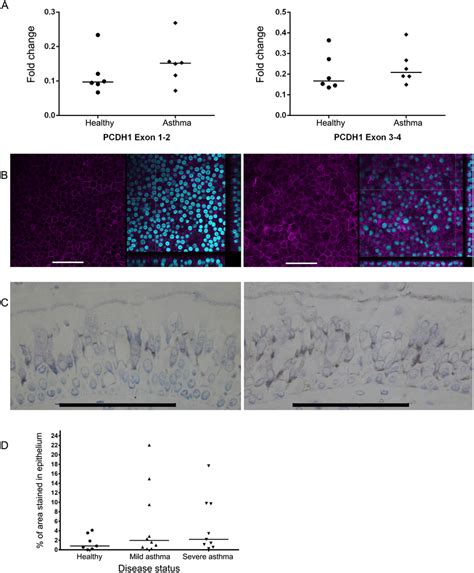 Pcdh1 Expression Levels And Subcellular Localization Patterns Are