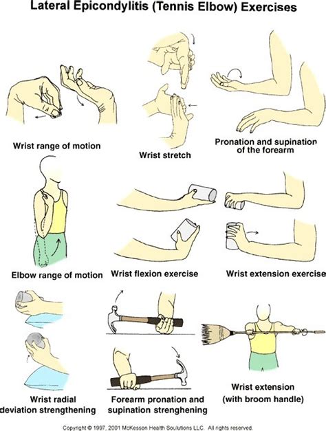 Peran Fisioterapi Pada Kasus Tennis Elbow Imfi Pusat