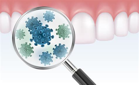 Todo Lo Que Debes Saber Sobre La Placa Bacteriana Dental Belleza Est Tica