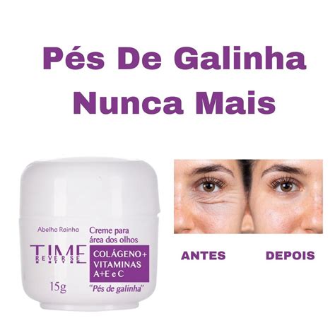 Melhor Creme Para Pés De Galinha Nos Olhos - Creme Para Área Dos Olhos "Pés de Galinha" Hidrata E Regenera Abelha ...