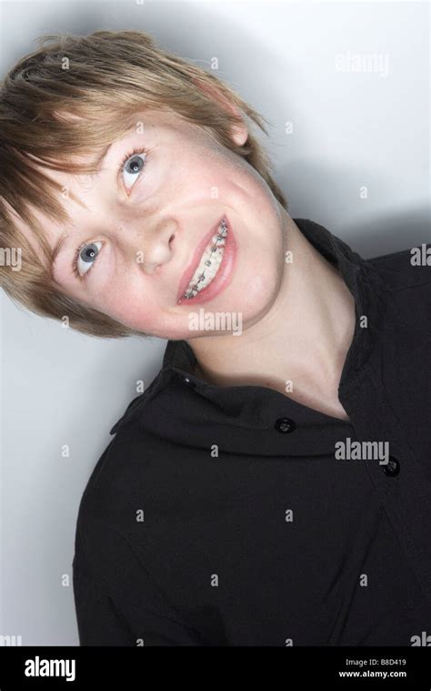 Boy Smiling Showing Braces Stock Photo Alamy