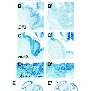 Loss Of Dll Dll And Hes And Ectopic Mash Expression In Mash