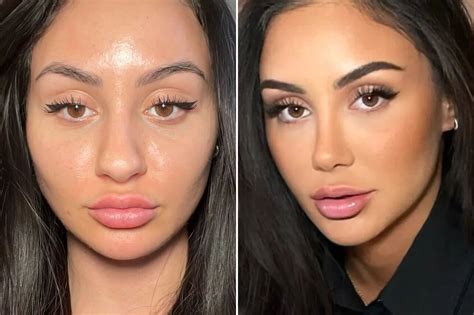 Barbie Nose Trend Is Viral On Tiktok Amid Barbiecore Craze