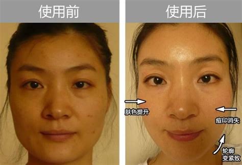 Nu Skin Ageloc™焕新系列—极致抗衰 Zclive