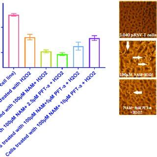 Effects of pifithrin α PFT α a p53 pathway inhibitor on morphology