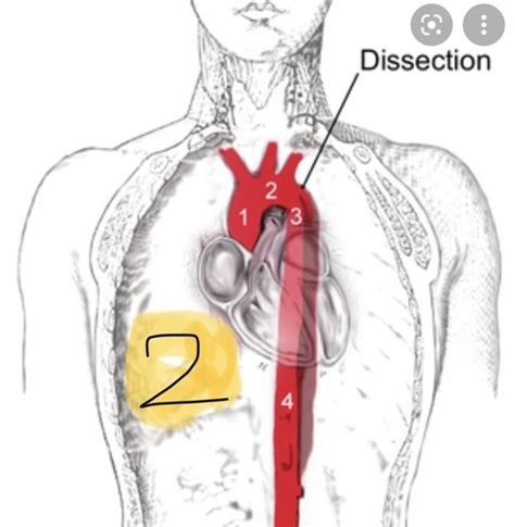 Cardiovascular System Flashcards Quizlet