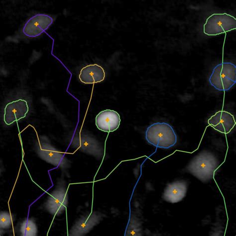 Single Cell Tracking Assay Holomonitor® Live Cell Assay Phi