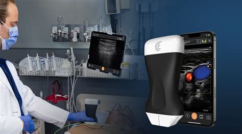 Clarius Pal Hd Whole Body Ultrasound Scanner Now Available In