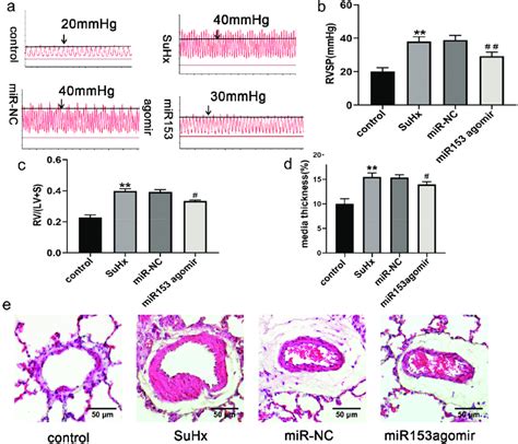 Mirna153 Alleviates Suhx Induced Ph And Right Ventricular Function In