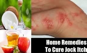 Home Remedies For Jock Itch | Healthy Tips