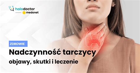 Nadczynność tarczycy objawy skutki i leczenie