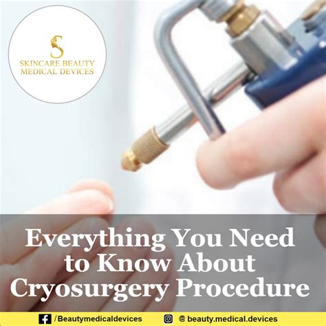 Everything You Need to Know About Cryosurgery Procedure