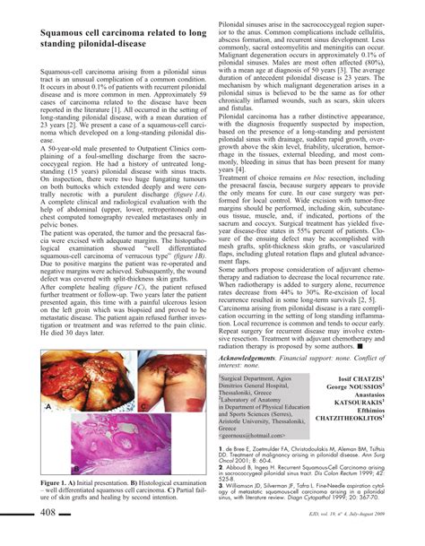 Pdf Squamous Cell Carcinoma Related To Long Standing Pilonidal Disease