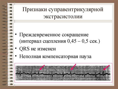 Нарушение сердечного ритма - презентация онлайн