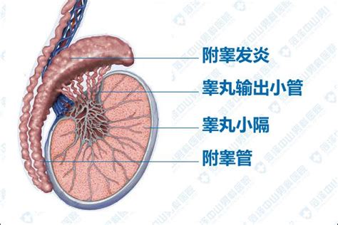 什麼是附睪炎 每日頭條