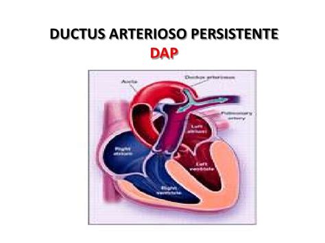 Cardiopatias Congenitas