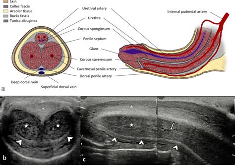 utility  contrast enhanced ultrasound ceus  penile trauma pmc