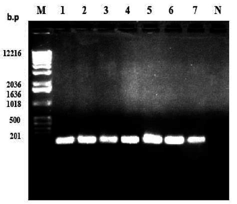 Agarose Gel Electrophoresis Of V Region Of S Rrna Gene Amplicons