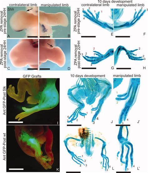 The Chicken Polydactyly Po Locus Causes Allelic Imbalance And Ectopic