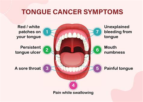 Tongue Cancer Stages Symptoms Causes Diagnosis And Treatment – NBKomputer