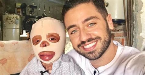 La Emotiva Historia De Mateo Un Niño De 3 Años Que Sobrevive Con El 90