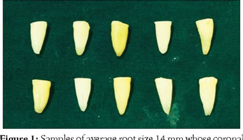 Figure From Fracture Resistance Of Endodontically Treated Tooth