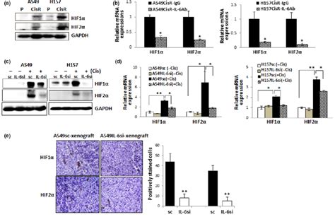 Interleukin Il Regulation Of Hypoxia Inducible Factor Hif