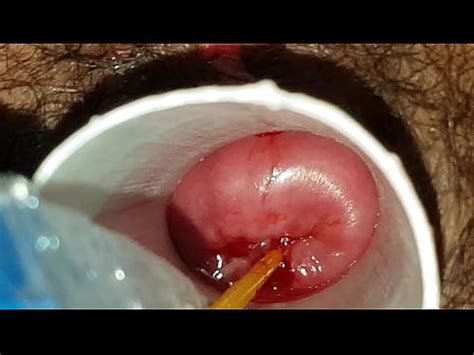 Colombian Amateur Cervix Play Part XVIDEOS