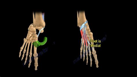 Subtalar Dislocation — OrthopaedicPrinciples.com