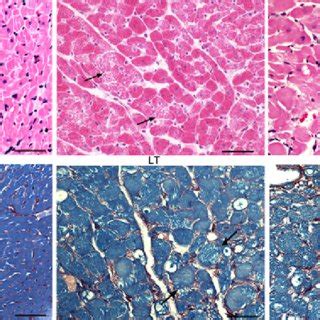A redox cycling of doxorubicin. This redox cycling process, the quinone ... 