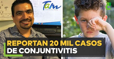 Reportan 20 Mil Casos De Conjuntivitis