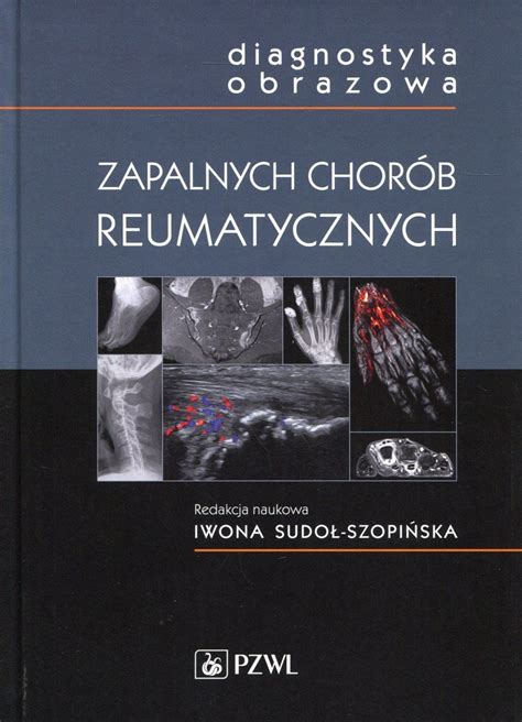 Diagnostyka Obrazowa Zapalnych Chor B Reumatycznych Opracowanie