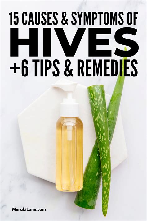 How To Get Rid Of Hives Whether Your Hives Or Urticaria Are Chronic