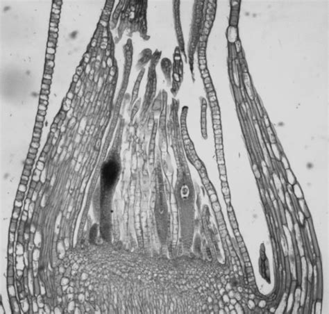 20.6: Bryophyta - Mosses - Biology LibreTexts