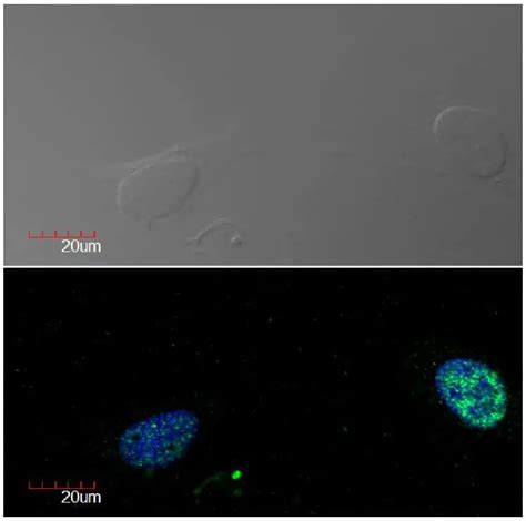 Anti Ki Antibody Ki Gtx Genetex