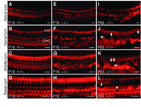 Progressive loss of outer hair cells in the organ of Corti of ...