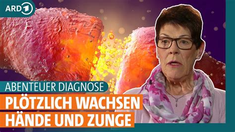 Abenteuer Diagnose Woher kommen Sprachstörungen und plötzlich