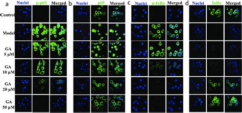 Indirect Immunofluorescence Assay And Confocal Fluorescence Images Of