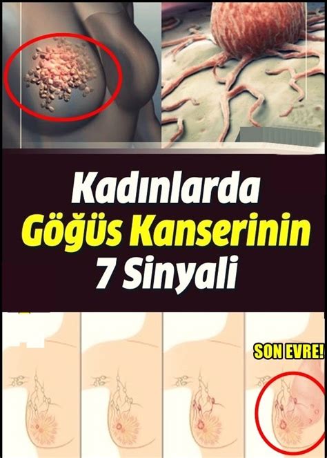 Kadınlarda Gögüs Kanserinin 7 Sinyali Detaylar