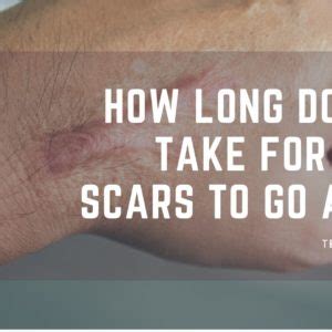 Surgery Scar Healing Stages - Treat Your Scars