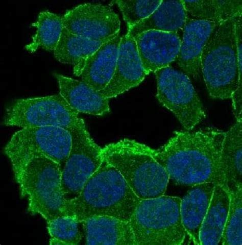 P120 Catenin Antibody Sr1036 Novus Biologicals 100 μg Unconjugated