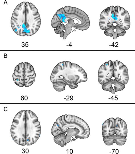 Gender Modulates The Apoe ε4 Effect In Healthy Older Adults Convergent