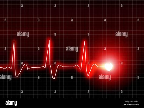 Ecg Stress Test Hi Res Stock Photography And Images Alamy