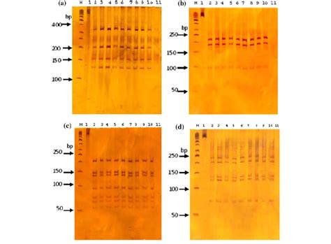 Photographs Of Polyacrylamid Gels Showing Pcr Rflp Profiles For X