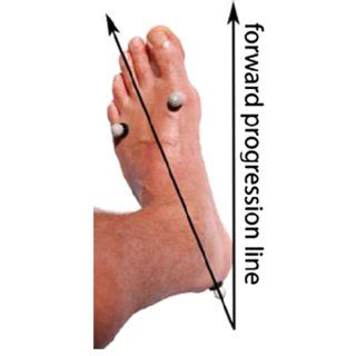 Foot progression angle: deWned as the angle between the foot axis and... | Download Scientific ...