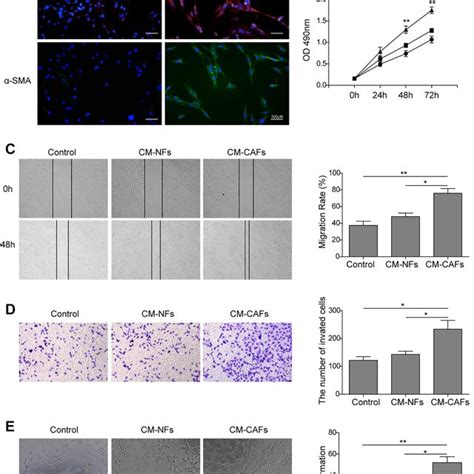 Cancer Associated Fibroblasts Promote Angiogenesis Via VEGF Secretion