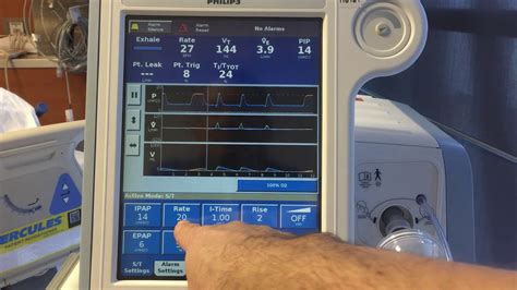 Non Invasive Ventilation Niv Basics Youtube