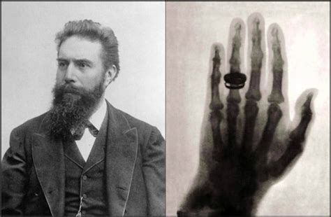 Primeira Radiografia Da História - 5 descobertas da medicina que mudaram a história | Página: 3 | O Imparcial